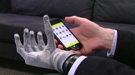 i-Limb Ultra Revolution - Touch Bionics