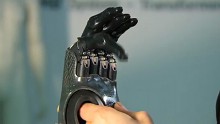 Die bionische Fingerprothese Pro Digits